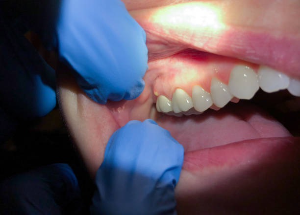 Best Orthodontic Emergency Dentist in Hollis, OK